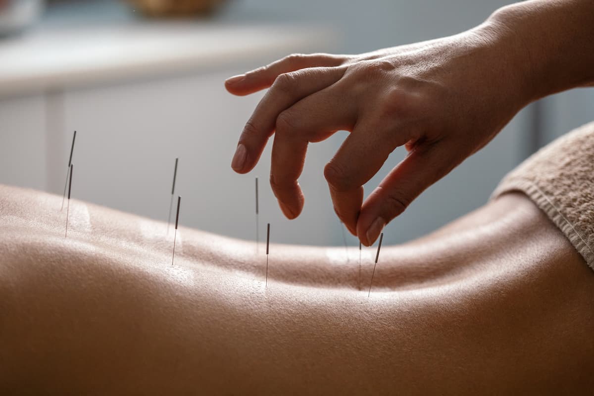 Health First Massage & Acupuncture Chermside